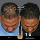 Plated Hair Serum - Image 3