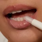 Lip Filler - Image 3